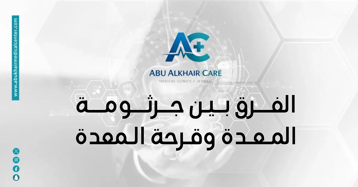 الفرق بين جرثومة المعدة وقرحة المعدة 