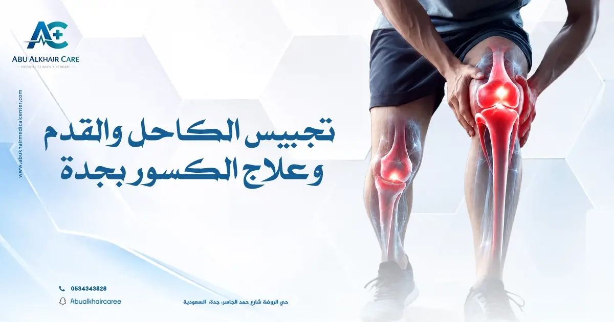 تجبيس الكاحل والقدم وعلاج الكسور بجدة | رعاية متكاملة