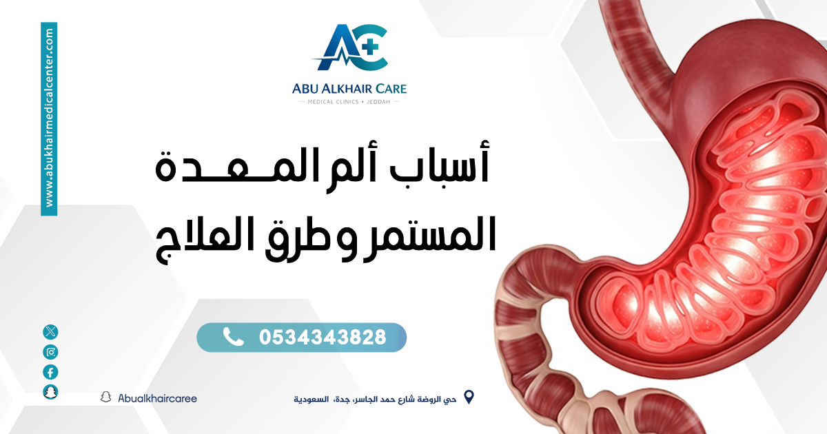 اسباب ألم المعدة المستمر