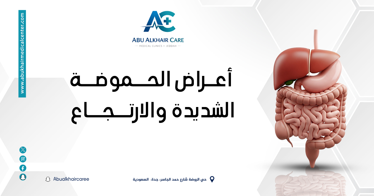 اعراض الحموضة الشديدة والارتجاع- الأسباب والعلاج وأفضل طرق الوقاية