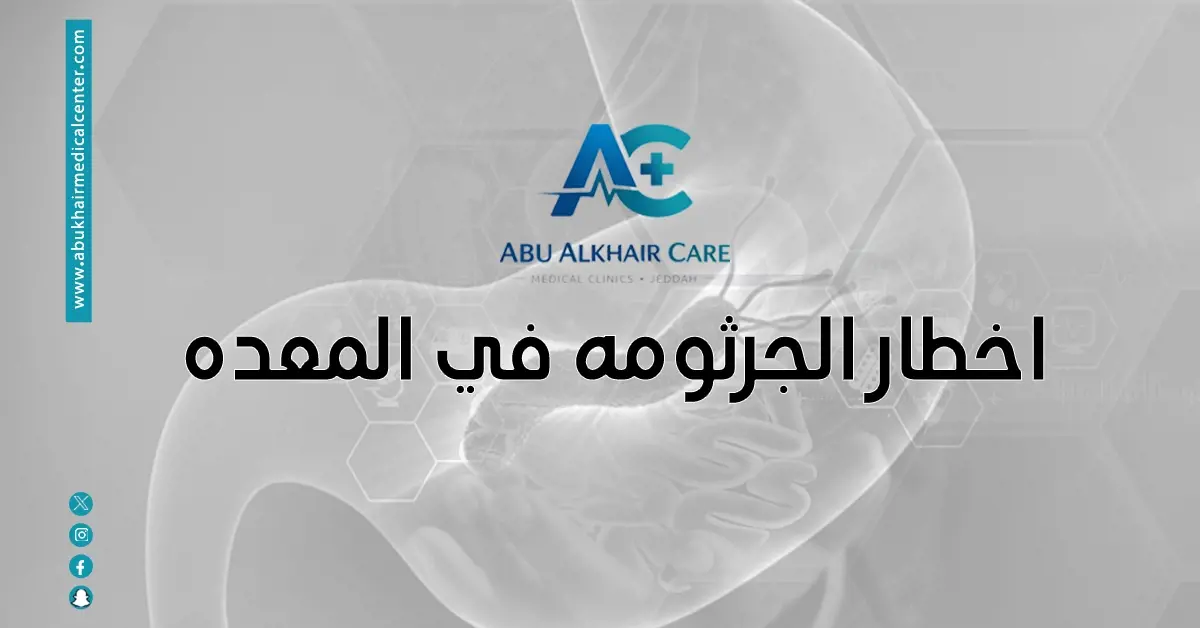 أسباب الجرثومة الحلزونية