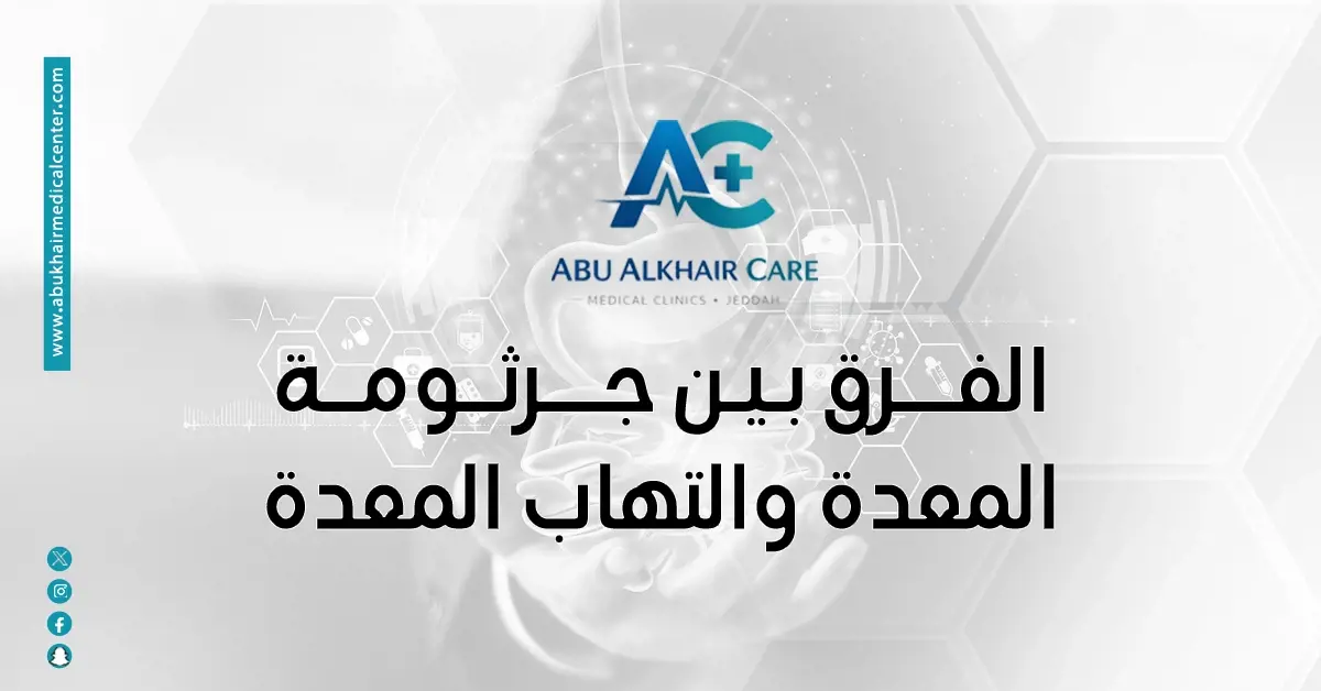 الفرق بين جرثومة المعدة والتهاب المعدة | الأسباب والعلاج