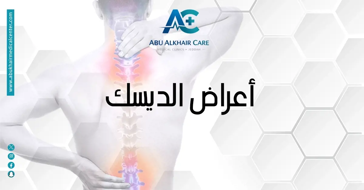 أعراض الديسك