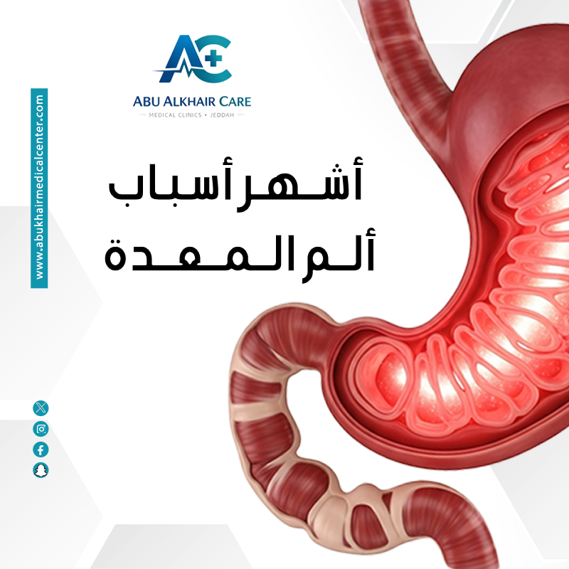 أشهر أسباب ألم المعدة المستمر