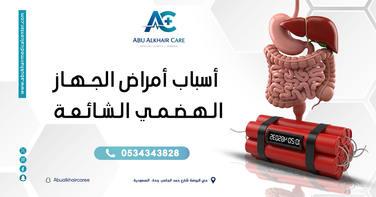 اسباب امراض الجهاز الهضمي: ما هي أهم الأسباب وكيف تؤثر على صحتك؟